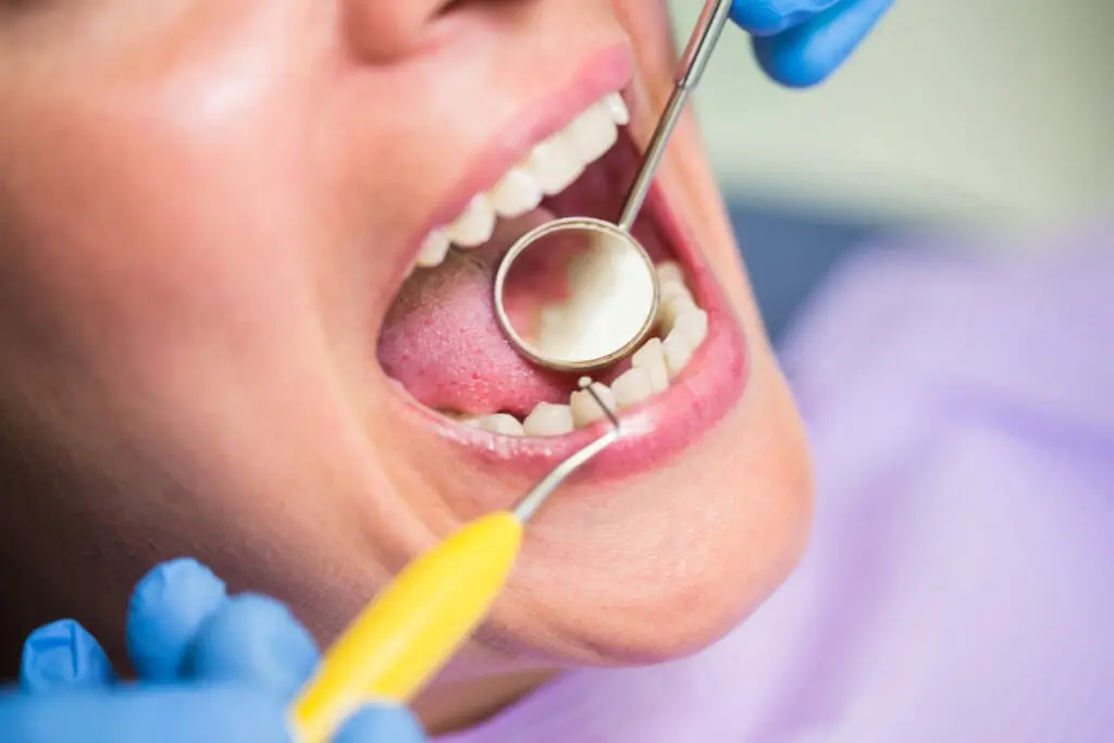 Dentist performing a periodontal maintenance cleaning and gum examination for gum disease in Brandywine.