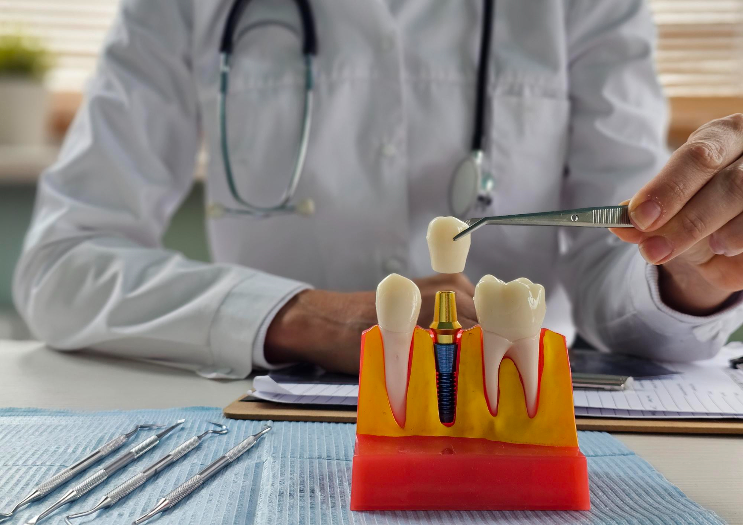 Dental professional demonstrating an All-on-4 dental implant restoration using a dental implant model.